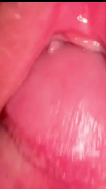 l** nhiều lông, hình 55