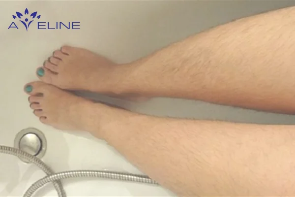 Bộ sưu tập l** nhiều lông — ảnh 99