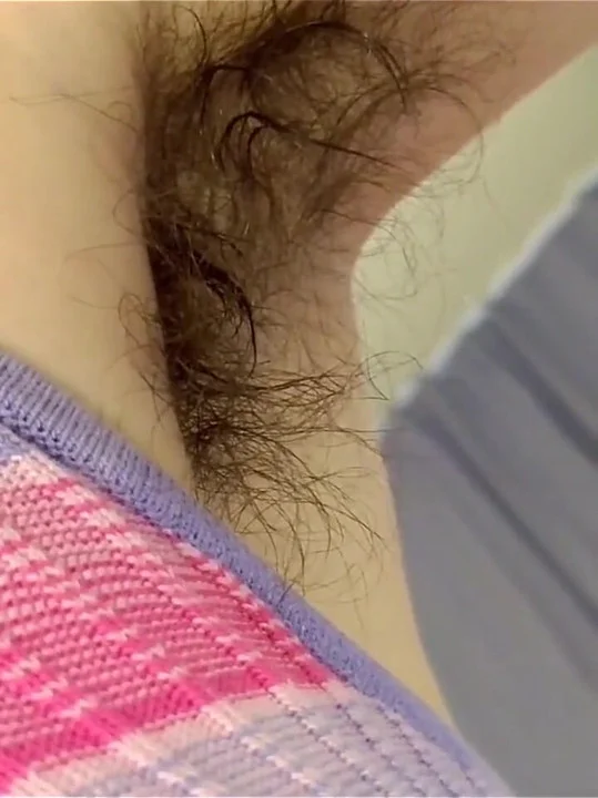 l** nhiều lông - mẫu 78